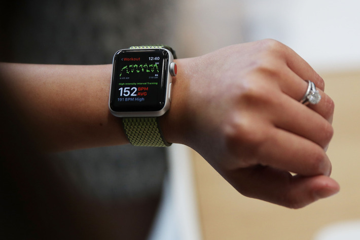 Hebat! Apple Watch Selamatkan Nyawa Pengguna dari Kecelakaan Fatal