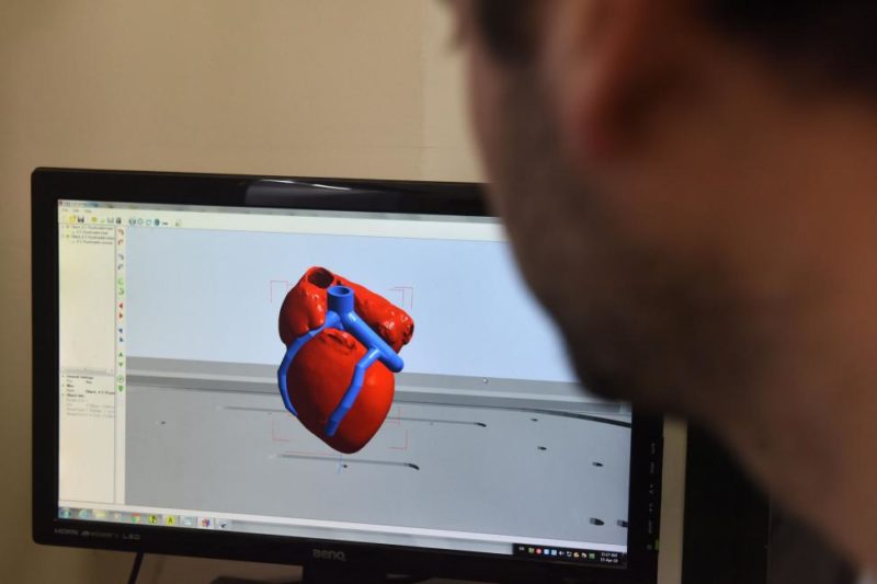 Ilmuwan Israel Berhasil Bikin Jantung Buatan, Dicetak 3D